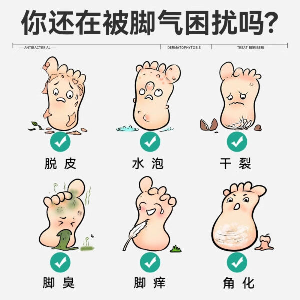 Luofu Bifenazole Solution Bifenazole Spray Genuine Bifenazole Spray Special Medicine Foot Odor - Image 3