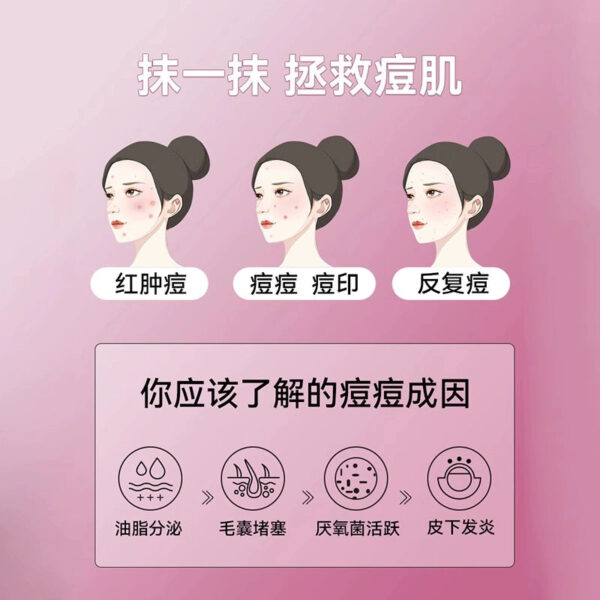 Liv metronidazole file gel acne repair dilute acne marks acne pit repair acne removal acne and acne marks - Image 4