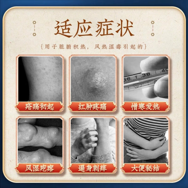 Tong Ren Tang Forsythia Biedu Pills Otitis Media Wind Heat Moisture Poison Rheumatoid Pimple Clearing Heat and Detoxifying Stool Secret Knot Flagship Store - Image 2